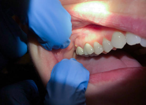 Best Emergency Cosmetic Dentistry in Oologah, OK